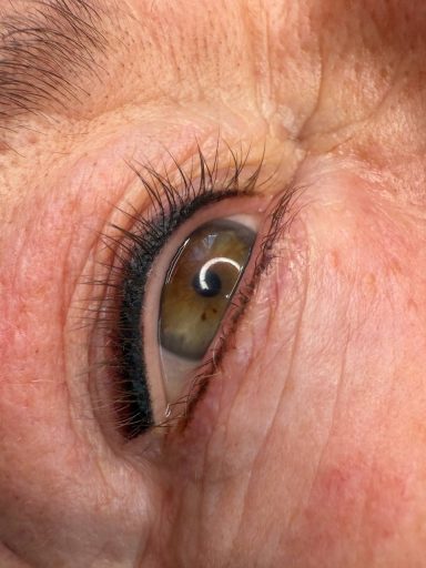 Wimpernkranz Verdichtung mit Schattierung